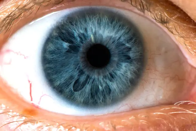 blue eye